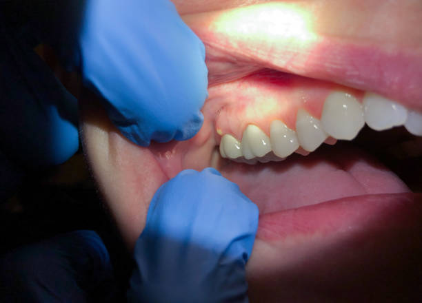 Best Broken or Chipped Tooth Repair in Bagdad, AZ