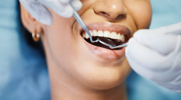 Best Broken or Chipped Tooth Repair in Bagdad, AZ